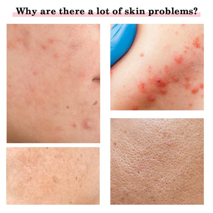 EMS Microcurrent Lifting & LED Facial Device – Anti Aging, Wrinkle Remover & Skin Rejuvenation