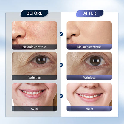 7 Colors LED Photon Machine with Nano Spray – Skin Rejuvenation & Moisturizing for Face & Body