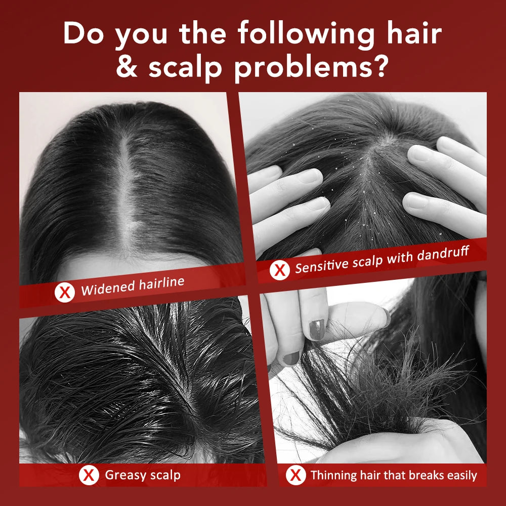 Electric Vibration Massage Comb with Red Light Therapy